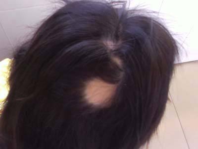      ���ʶ���ͺ������֢״����Щ��